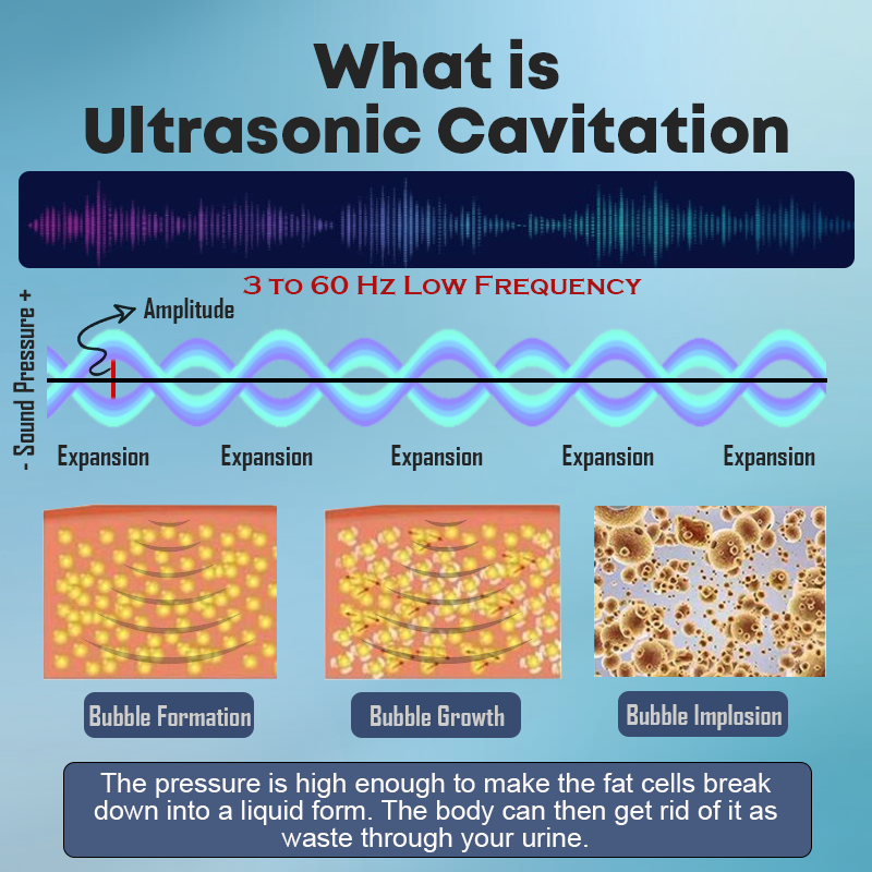 CZTICLE™ Ultrasonic Fat Blasting & Far Infrared Blood Sugar Balancing Detox Wristband(👩‍🔬Recommended by PlasticSurgeons)